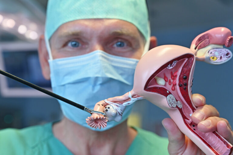 EileiterEntfernung als Vorbeugung gegen Eierstockkrebs akzeptiert Stiftung Eierstockkrebs